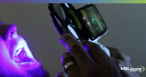 The VELscope Mantis captures and displays a fluorescence image of oral tissue on its mounted iPhone in real time while the patient's mouth is illuminated under blue-light fluorescence.