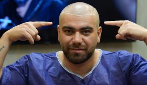 Hairline planning consultation for a natural-looking hair transplant in the Gulf
