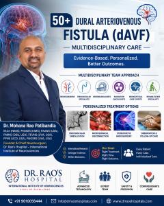 Dr. Mohana Rao Patibandla explaining multidisciplinary treatment for dural arteriovenous fistulas (DAVFs), highlighting advanced neuroimaging, endovascular embolization, microsurgery, stereotactic radiosurgery, and comprehensive cerebrovascular care at Dr