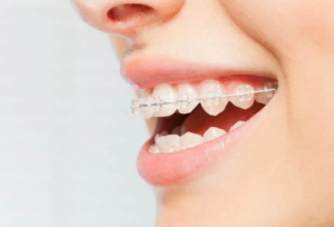 LA Holistic Orthodontics