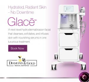 Diamond & Gold in Five Towns, New York now has the Glace device