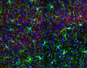 Green, blue and red brain cells assembled in a colorful mosaic pattern