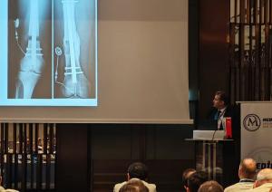 Prof. Dr. Halil İbrahim Balcı, MD, FEBOT, of the Istanbul Limb Lengthening & Reconstruction Centre (ILLRC), discussing patient selection and safety in cosmetic limb lengthening surgery.