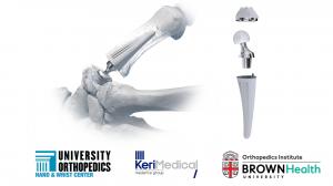 TOUCH CMC 1 Thumb Prosthesis with logos