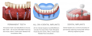 Albany Implant Clinic Services