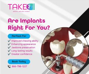 Are Implats Right for You - Take 2 Dental Implant Studio in Anchorage, AK