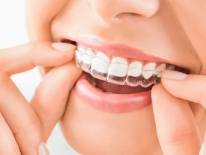 Invisalign in Los Angeles