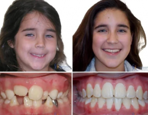 Before and After Treatment.