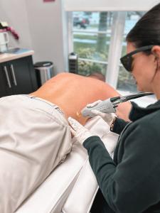 laser-hair-removal-on-a-male-in-jupiter-fl