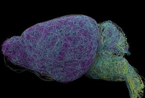 Colorful wires filling an outline of a brain seen in profile