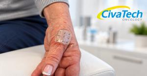 Patient wearing the CivaDerm radiation therapy device on the back of the hand during treatment in a clinical setting.