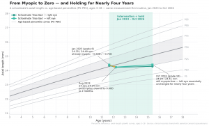 Axial-length chart of a schoolmate whose myopia was cleared to 0.00D in seven months on a measurement-first routine, holding myopia-free from January 2023 to October 2026.