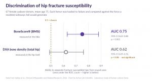 Chart comparing how well two measurements separated fracture-susceptible hips from sound ones in a cadaver laboratory study: BoneScore (BMSi, measured at the tibia) scored AUC 0.75 with a confidence interval entirely above chance, while DXA total-hip bone