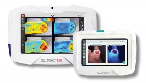 Kent Imaging's SnapshotNIR and SnapshotGLO portable, handheld medical imaging devices