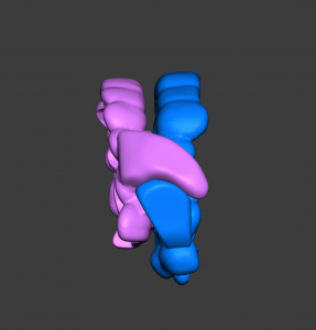 Connected Arc of Motion (CAOM) that defies gravity in supine body position.