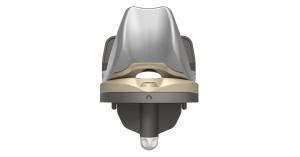Klassic Knee - Modern Universal Femur