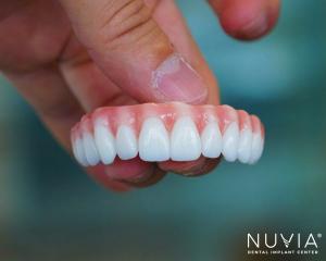Nuvia's Permanent Zirconia Teeth Prosthetic That Attaches to Full Mouth Dental Implants