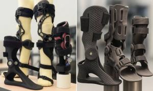 Custom AFO, Ankle & Knee Braces