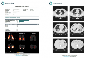 contextflow developed a COVID-19 pdf report featuring lung CTs