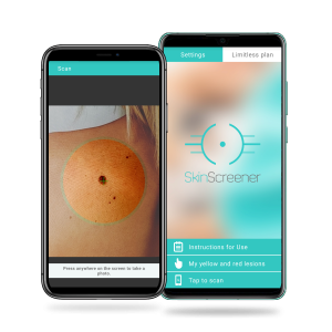 Skin cancer app SkinScreener