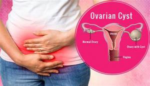 30 Minute Frequency Specific Microccurrent Treatment Provides Relief from Ovarian Cysts