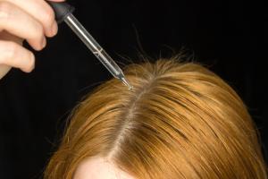 Hair Serum Market is Anticipated to Grow at a Sluggish CAGR of 8.4% Through 2026