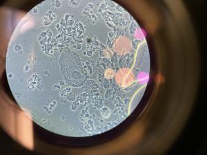 The outstanding amount of bacteria is an indication of the severity of this patient's periodontal disease.