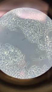 Patient's microscope sample demonstrates substantial reduction of disease causing bacteria and parasites, and improvement in his oral health.