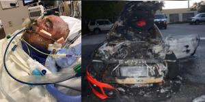 Side by side pictures. Left is closeup of Hetsler hooked up to hospital ventilator. On right side is completely burned out car after the fire