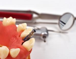 Fake mouth getting dental implant