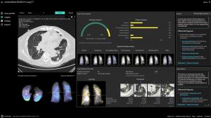 contextflow SEARCH Lung CT's user interface