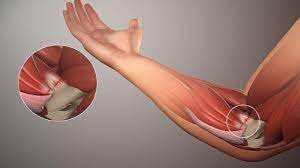 Soft tissue repair market