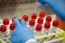 Fungal Testing Kits Market