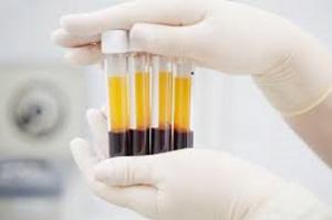 Platelet Rich Plasma Market