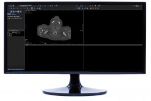 contextflow SEARCH Lung CT Integration into Dedalus DeepUnity