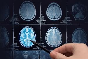 Medical Image Processing Market