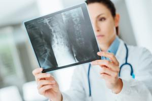 Digital Radiography Market