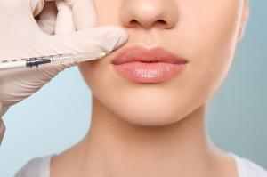 Lip augmentation Market