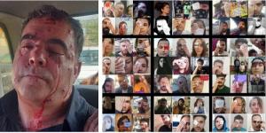 9/12/2021-These in turn sparked familiar crackdowns by regime authorities, with  300 people having been arrested during unrest in Isfahan. About 40 of those protesters were struck in the face by projectiles and left blind in at least one eye.