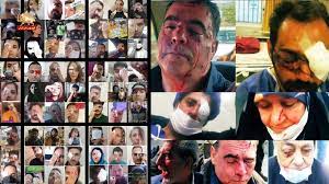  14/12/2021-Protest in Isfahan led to 100 people being wounded and 300 arrested when security forces opened fire with supposedly “less-lethal” projectiles. Several victims were blinded in at least one eye after being shot brutally at close range.