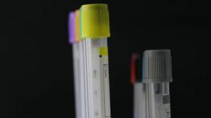 Phlebotomy Tubes Market