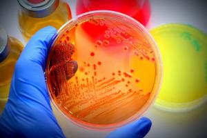 Microbiology culture market