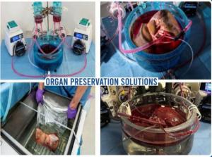 Organ Preservation Solutions Market