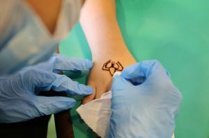 Tattoo Removal Service Market
