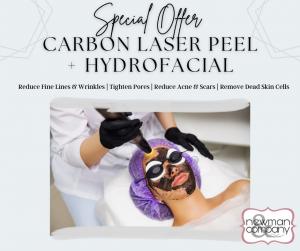 Laser Tattoo Removal