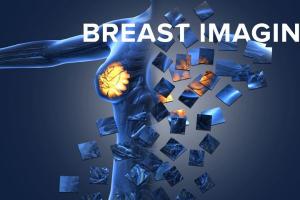Breast Imaging Market