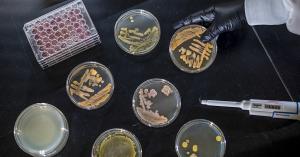 Petri dishes with bacteria cultures on a black science bench.