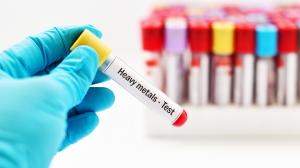 Heavy Metal Testing Market