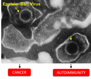 Epstein–Barr Virus: Silencing the Enemy within
