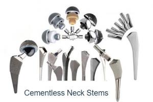 Cementless Neck Stems Market